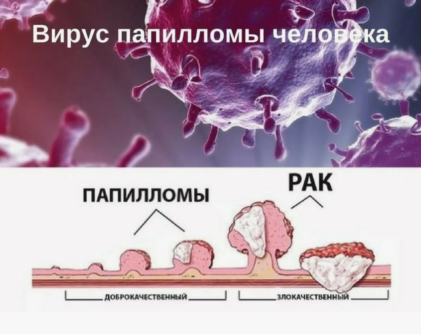 ываываыва